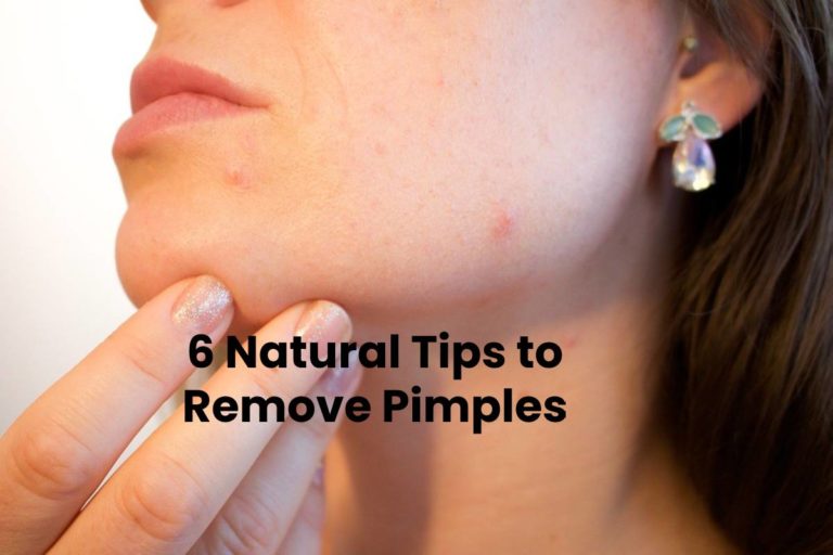 6 Natural Tips to Remove Pimples