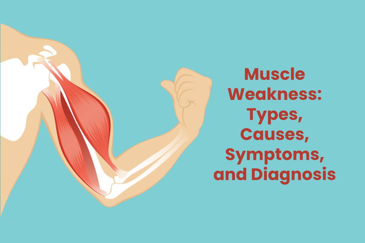 Muscle Weakness Types Causes Symptoms And Diagnosis SBH