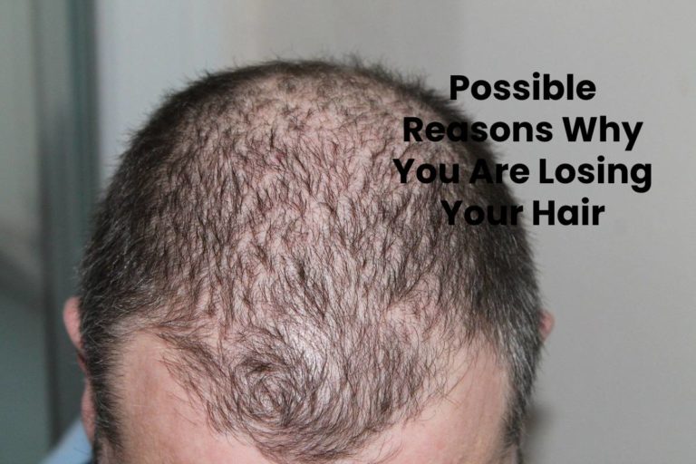 Possible Reasons Why You Are Losing Your Hair