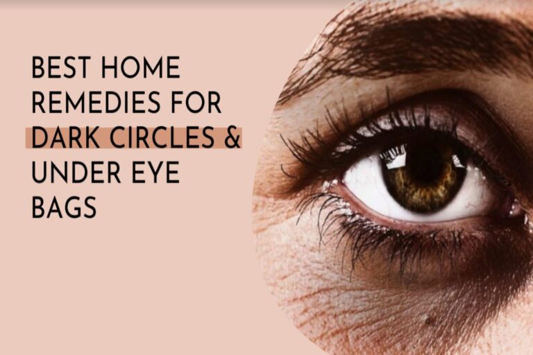 Best Home Remedies for Dark Circles & Under Eye Bags