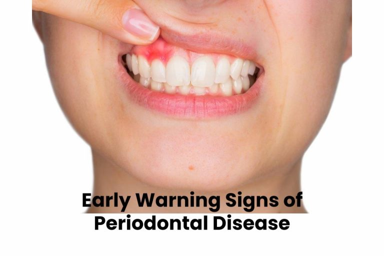 Early Warning Signs of Periodontal Disease