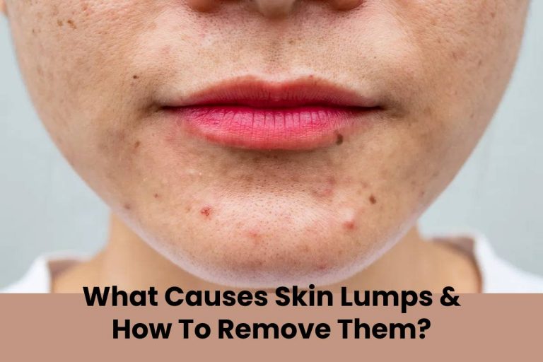 What Causes Skin Lumps & How To Remove Them?