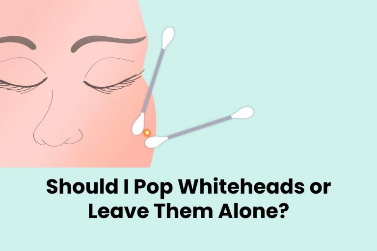 Should I Pop Whiteheads or Leave Them Alone?