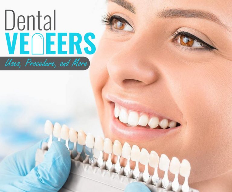 Dental Veneers: Uses, Procedure, and More