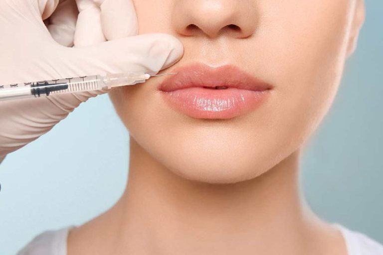 What You Must Understand About Dermal Fillers