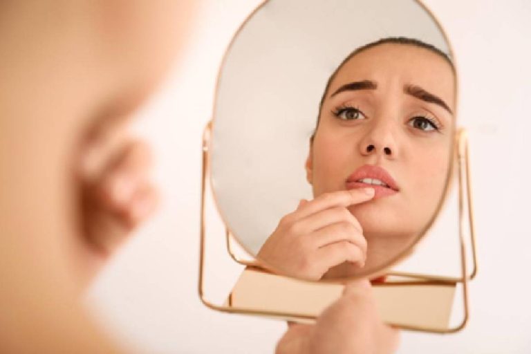 5 Ways to Avoid Chapped Lips